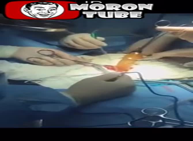 Video: A snake emerged from a person's stomach, still alive ()